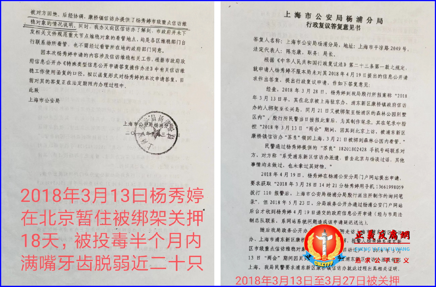 2018年3月,上海访民被关黑监狱18 天牙齿掉了近20 颗。.png 2018年3月,上海访民被关黑监狱18 天牙齿掉了近20 颗。.png
